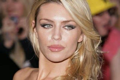 abbey clancy plastic surgery|abbey clancy face treatment.